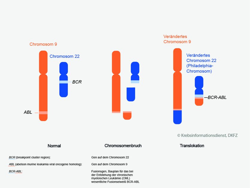 Translokation bei Philadelphia-Chromosom