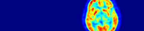 Aufnahme eines Positronen-Emissionstomographen (PET).