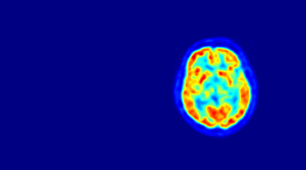 Aufnahme eines Positronen-Emissionstomographen (PET).