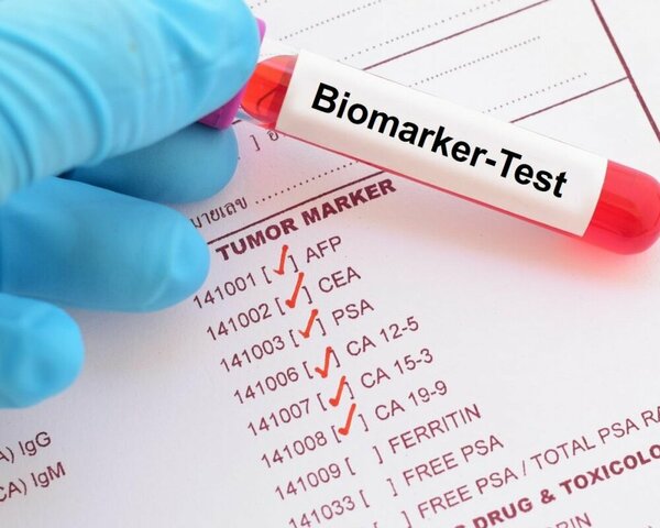 Blutröhrchen mit Label "Biomarker-Test" auf einer Liste von Tumormarkern