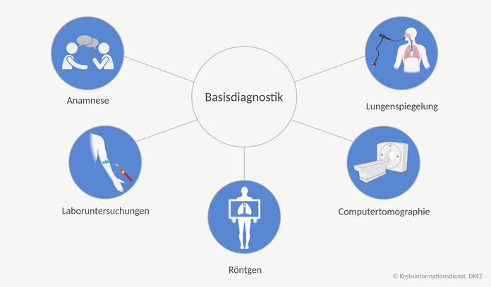 Zur Basisdiagnostik bei Lungenkrebs gehören das Erfragen der Krankheitsvorgeschichte (Anamnese), die körperliche Untersuchung, Laboruntersuchungen, Röntgen der Brust, Computertomographie (CT) der Brust und die Lungenspiegelung (Bronchoskopie)