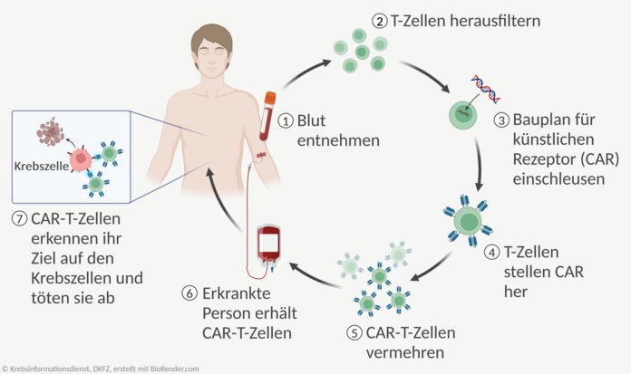 Ablauf einer CAR-T-Zell-Therapie