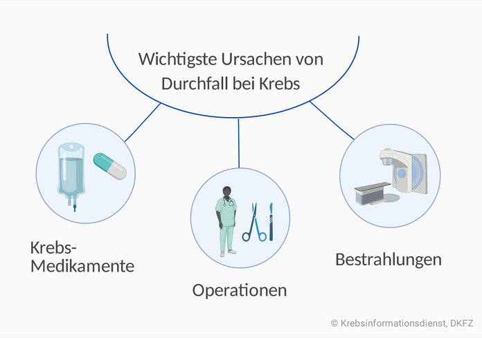 Grafische Darstellung der wichtigsten Ursachen von Durchfall bei Krebs: Krebs-Medikamente, Operationsfolgen und Bestrahlungen