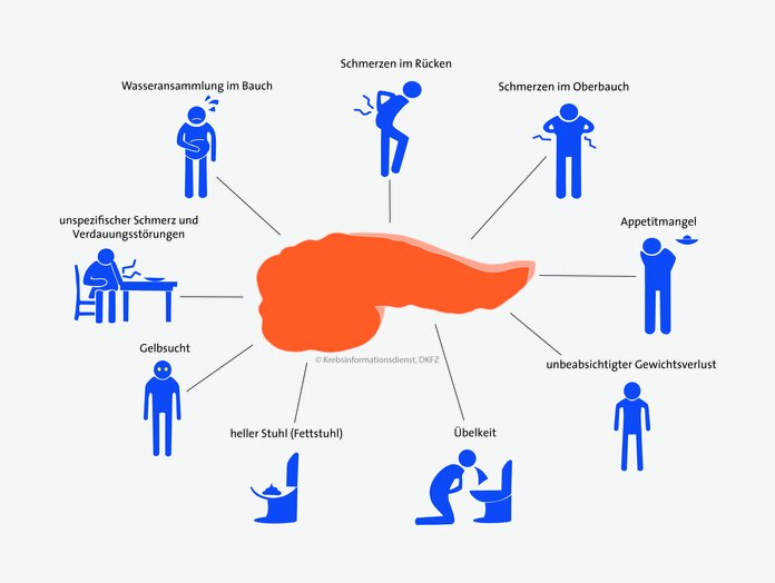 Mindmap verschiedener Beschwerden, die auf Bauchspeichelkrebs hinweisen können.