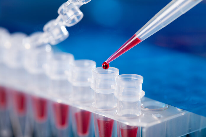 Mikroliterpipette tropft in ein PCR-Röhrchen