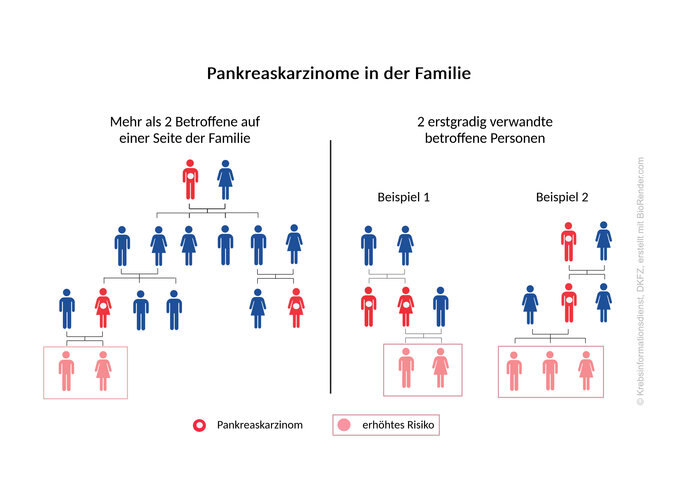 Pankreaskarzinome in der Familie, dargestellt im Stammbaum: Beispiele für die sporadische Form und die familiäre Form.