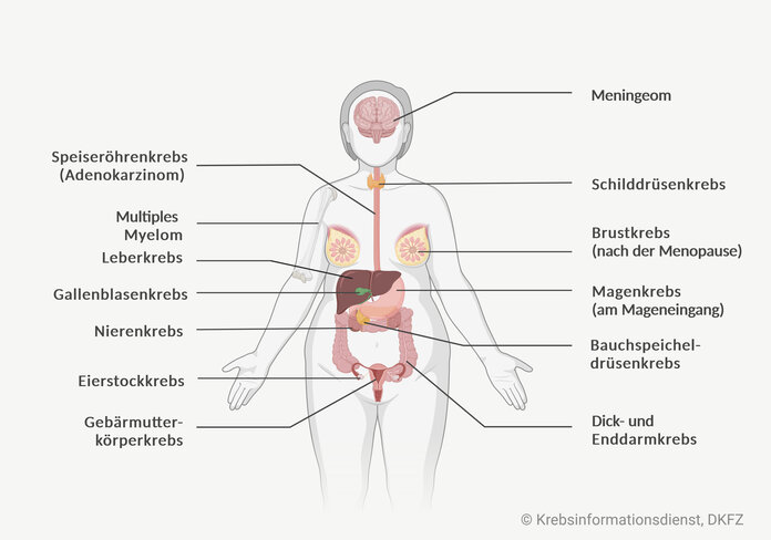 Menschliche Silhouette mit Beschriftungen: Speiseröhrenkrebs, Multiples Myelom, Leberkrebs, Gallenblasenkrebs, Nierenkrebs, Eierstockkrebs, Gebärmutterkörperkrebs, Meningeom, Schilddrüsenkrebs, Brustkrebs (nach der Menopause), Magenkrebs (am Mageneingang), Bauchspeicheldrüsenkrebs, Dick- und Enddarmkrebs.